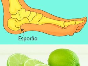 receita caseira com limão para aliviar o esporão