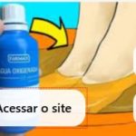 micose