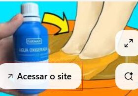 micose